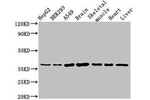Western Blot Positive WB detected in: HepG2 whole cell lysate, HEK293 whole cell lysate, A549 whole cell lysate, Mouse brain tissue, Mouse skeletal muscle tissue, Rat heart tissue, Rat liver tissue All lanes: MYF6 antibody at 3 μg/mL Secondary Goat polyclonal to rabbit IgG at 1/50000 dilution Predicted band size: 27 kDa Observed band size: 37 kDa (MYF6 anticorps  (AA 26-232))