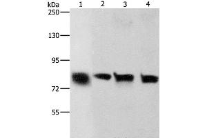 Western Blot analysis of Hela and A549 cell, Human liver cancer tissue and HT-29 cell using K-Cadherin Polyclonal Antibody at dilution of 1:500 (CDH6 anticorps)