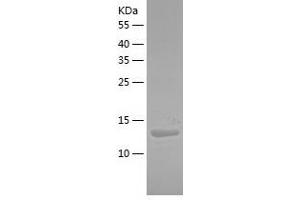 Western Blotting (WB) image for Adipogenesis Associated Mth938 Domain Containing (AAMDC) (AA 1-122) protein (His-IF2DI Tag) (ABIN7121725)