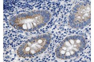 ABIN6267651 at 1/100 staining human Appendix tissue sections by IHC-P.