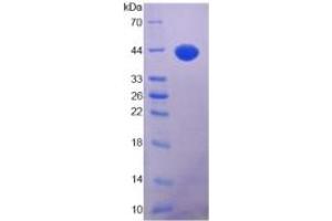 SDS-PAGE of Protein Standard from the Kit  (Highly purified E. (IGF1 Kit ELISA)