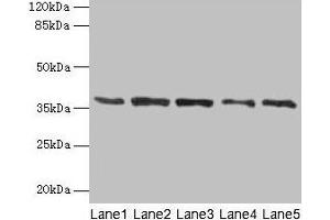 Western blot All lanes: PLAUR antibody at 4 μg/mL Lane 1: Mouse brain tissue Lane 2: A2780 whole cell lysate Lane 3: MCF-7 whole cell lysate Lane 4: Hela whole cell lysate Lane 5: Colo320 whole cell lysate Secondary Goat polyclonal to rabbit IgG at 1/10000 dilution Predicted band size: 37, 32, 33 kDa Observed band size: 37 kDa (PLAUR anticorps  (AA 23-305))