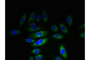 Immunofluorescent analysis of A549 cells using ABIN7157483 at dilution of 1:100 and Alexa Fluor 488-congugated AffiniPure Goat Anti-Rabbit IgG(H+L) (KHDC1 anticorps  (AA 74-237))
