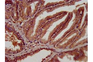 IHC image of ABIN7162139 diluted at 1:300 and staining in paraffin-embedded human prostate tissue performed on a Leica BondTM system.