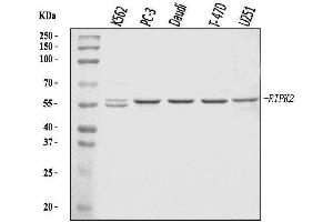 Western blot analysis of RIP2/RIPK2 using anti-RIP2/RIPK2 antibody (ABIN7600113).