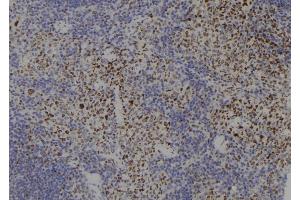 ABIN6277766 at 1/100 staining Mouse spleen tissue by IHC-P. (SMC3 anticorps  (C-Term))