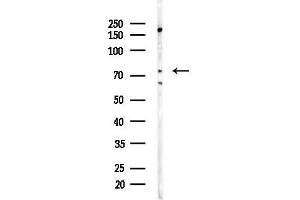 Western blot analysis of lysates from COLO205 cells(heat-shock,45 min treatment), using OC Antibody at 1/1000 dilution.