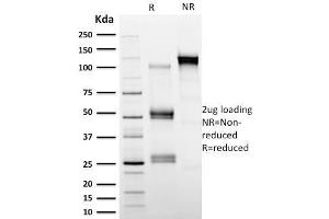 SDS-PAGE Analysis Purified Calpastatin Mouse Monoclonal Antibody (CAST/1550).