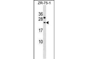 Western blot analysis in ZR-75-1 cell line lysates (35ug/lane). (CCDC140 anticorps  (N-Term))