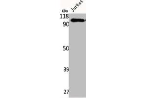 Western Blot analysis of Jurkat cells using Integrin β5 Polyclonal Antibody (Integrin beta 5 anticorps  (C-Term))