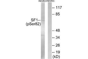 Western blot analysis of extracts from HUVEC cells treated with anisomycin using SF1 (Phospho-Ser82) Antibody. (Splicing Factor 1 anticorps  (pSer82))