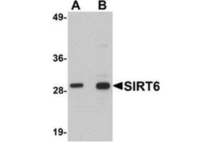 Western blot analysis of SIRT6 in HeLa cell lysate with SIRT6 antibody at (A) 0. (SIRT6 anticorps  (C-Term))