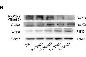BCAA increase PPAR-α expression in a GCN2/ATF6 pathway-dependent manner. (beta Actin anticorps)