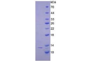 SDS-PAGE analysis of Human CTNNbIP1 Protein. (CTNNBIP1 Protéine)