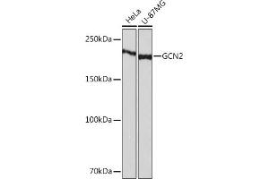 Western blot analysis of extracts of various cell lines, using GCN2 Rabbit mAb (ABIN1679532, ABIN3015972, ABIN3015973 and ABIN7101471) at 1:1000 dilution. (GCN2 anticorps)