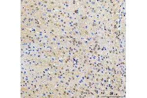 IHC analysis of RTF1 using anti-RTF1 antibody (ABIN7602444). (RTF1 anticorps  (AA 77-705))
