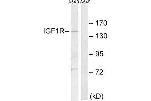 Western Blotting (WB) image for anti-Insulin-Like Growth Factor 1 Receptor (IGF1R) (Tyr1346) antibody (ABIN1848190) (IGF1R anticorps  (Tyr1346))