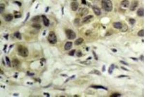 Image no. 3 for anti-Nibrin (NBN) (pSer343) antibody (ABIN318326) (Nibrin anticorps  (pSer343))