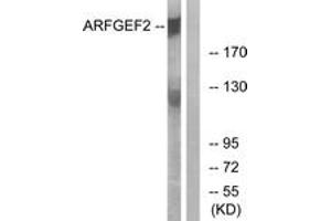 Western blot analysis of extracts from A549 cells, using ARFGEF2 Antibody. (ARFGEF2 anticorps  (AA 1491-1540))