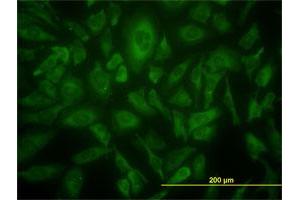 Immunofluorescence of monoclonal antibody to USP9X on HeLa cell. (USP9X anticorps  (AA 1-90))