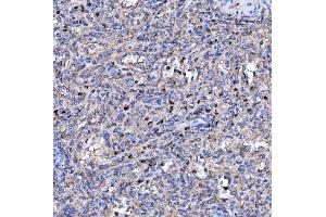 IHC analysis of RAB3GAP1 using anti-RAB3GAP1 antibody (ABIN7599702). (RAB3GAP1 anticorps  (AA 109-810))