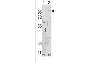 Western blot analysis of FGFR2 (arrow) using rabbit polyclonal FGFR2 Antibody (ABIN391968 and ABIN2841764).