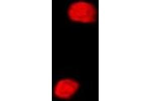 Immunofluorescent analysis of SETD5 staining in MCF7 cells.