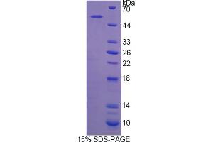 Image no. 1 for Pygopus Homolog 2 (PYGO2) (AA 171-406) protein (His tag,GST tag) (ABIN4990983) (PYGO2 Protein (AA 171-406) (His tag,GST tag))