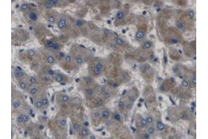 DAB staining on IHC-P; Samples: Human Liver Tissue