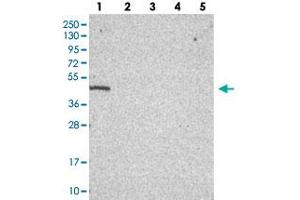 Western blot analysis of Lane 1: RT-4, Lane 2: U-251 MG, Lane 3: Human Plasma, Lane 4: Liver, Lane 5: Tonsil with C19orf47 polyclonal antibody  at 1:100-1:250 dilution. (C19orf47 anticorps)