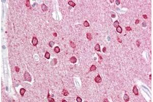 Anti-PACSIN1 antibody IHC staining of human brain, cortex. (PACSIN1 anticorps  (AA 2-15))