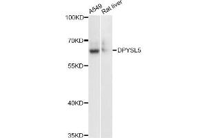 Western blot analysis of extracts of various cell lines, using DPYSL5 antibody (ABIN6291929) at 1:3000 dilution. (DPYSL5 anticorps)
