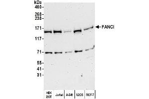 Western Blotting (WB) image for anti-Fanconi Anemia Complementation Group I (FANCI) (AA 1025-1075) antibody (ABIN7451779)