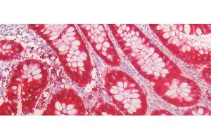 Detection of GAL3 in Human Colon Tissue using Polyclonal Antibody to Galectin 3 (GAL3)