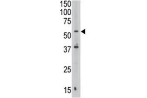 Western Blotting (WB) image for anti-Septin 9 (SEPT9) antibody (ABIN3002552) (Septin 9 anticorps)