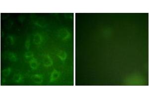 Immunofluorescence (IF) image for anti-Platelet Derived Growth Factor Receptor beta (PDGFRB) (AA 991-1040) antibody (ABIN2888856)