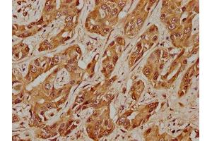 anti-Ubiquitin Specific Peptidase 17-Like Family Member 5 (USP17L5) (AA 19-235) antibody