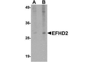 Western blot analysis of EFHD2 in mouse brain tissue lysate with AP30310PU-N EFHD2 antibody at (A) 1 and (B) 2 μg/ml. (EFHD2 anticorps  (N-Term))