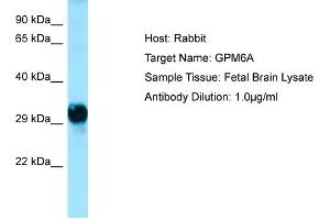Host: Rabbit  Target Name: GPM6A  Antibody Dilution: 1. (GPM6A anticorps  (C-Term))