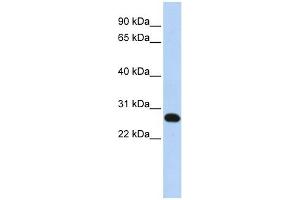 FAM119A antibody used at 1 ug/ml to detect target protein.