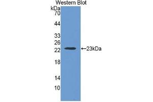 WB of Protein Standard: different control antibodies against Highly purified E.