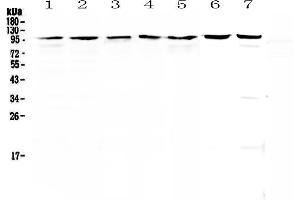 Western blot analysis of Topoisomerase I using anti-Topoisomerase I antibody . (Topoisomerase I anticorps  (AA 526-765))
