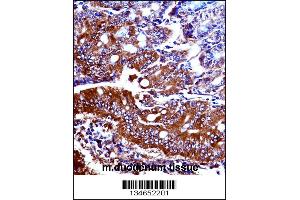 Mouse Npr1 Antibody immunohistochemistry analysis in formalin fixed and paraffin embedded mouse duodenum tissue followed by peroxidase conjugation of the secondary antibody and DAB staining.