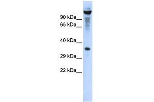 RNASET2 antibody used at 1 ug/ml to detect target protein.