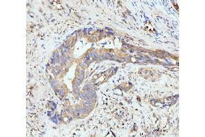 IHC analysis of GIT1 using anti-GIT1 antibody (ABIN7601683). (GIT1 anticorps  (AA 415-736))