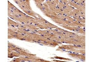 IHC analysis of ACTN2 using anti-ACTN2 antibody (ABIN7602055). (ACTN2 anticorps  (AA 567-696))