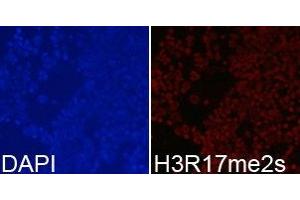 Immunofluorescence analysis of 293T cell using H3R17me2s antibody. (Histone 3 anticorps  (H3R17me2s))