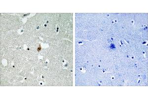 Peptide - +Immunohistochemistry analysis of paraffin-embedded human brain tissue usingantibody. (TCF3 anticorps  (Internal Region))