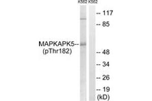 Western blot analysis of extracts from K562 cells treated with Na3VO4 0. (MAPKAP Kinase 5 anticorps  (pThr182))