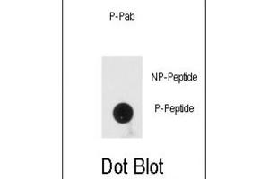 Dot Blot (DB) image for anti-Protein Kinase, Interferon-Inducible Double Stranded RNA Dependent Activator (PRKRA) (pSer246) antibody (ABIN3001881) (PRKRA anticorps  (pSer246))